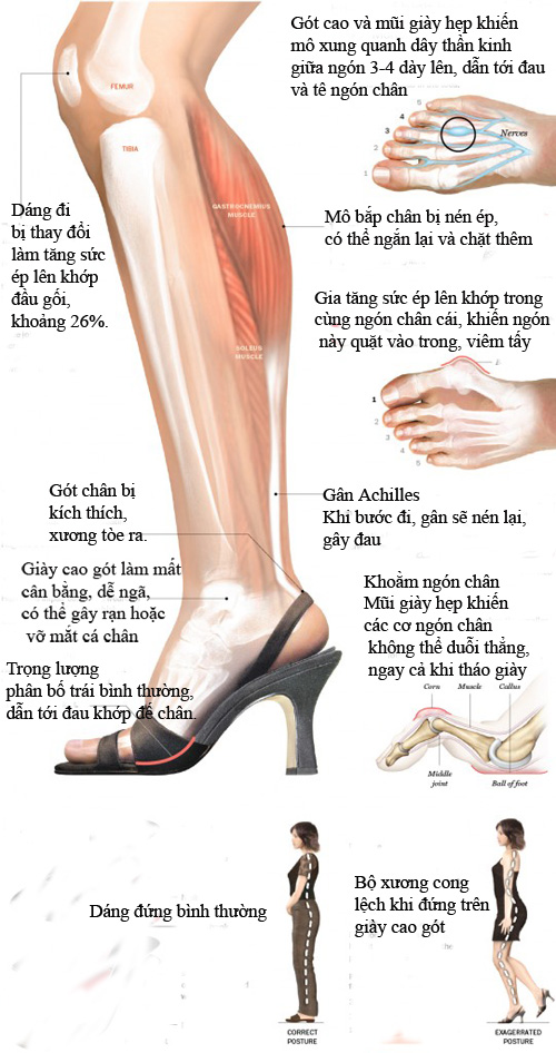 Giày cao gót gây hại cho sức khỏe của các nàng như thế nào?