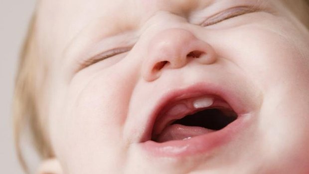 Các nguy cơ, ảnh hưởng của bệnh lý răng miệng ở trẻ